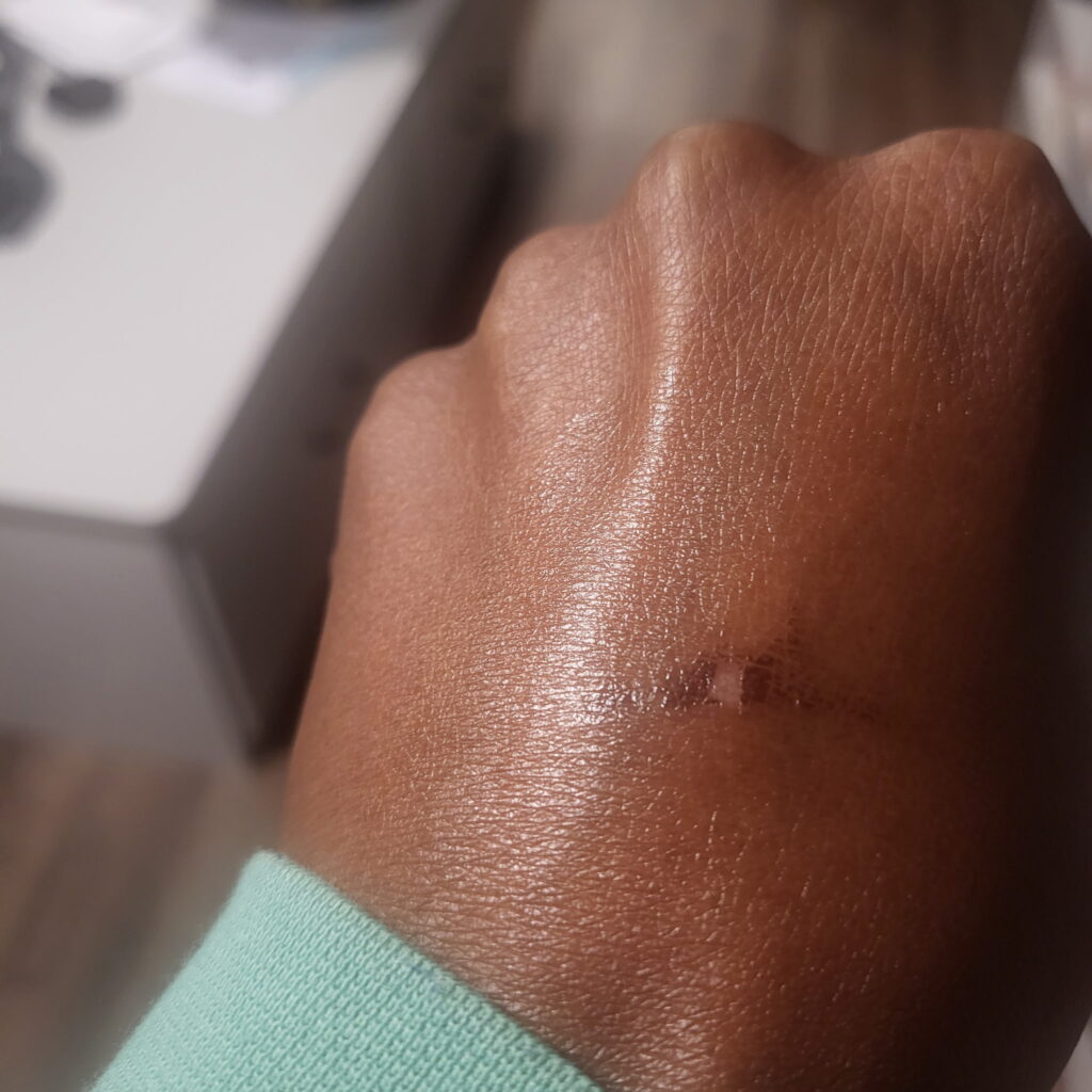Visible Burn Recovery Stage